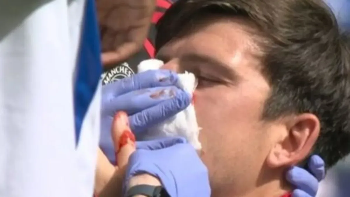 Harry Maguire deixa campo sangrando após choque com jogador do Everton